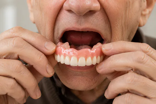 Complete and partial dentures